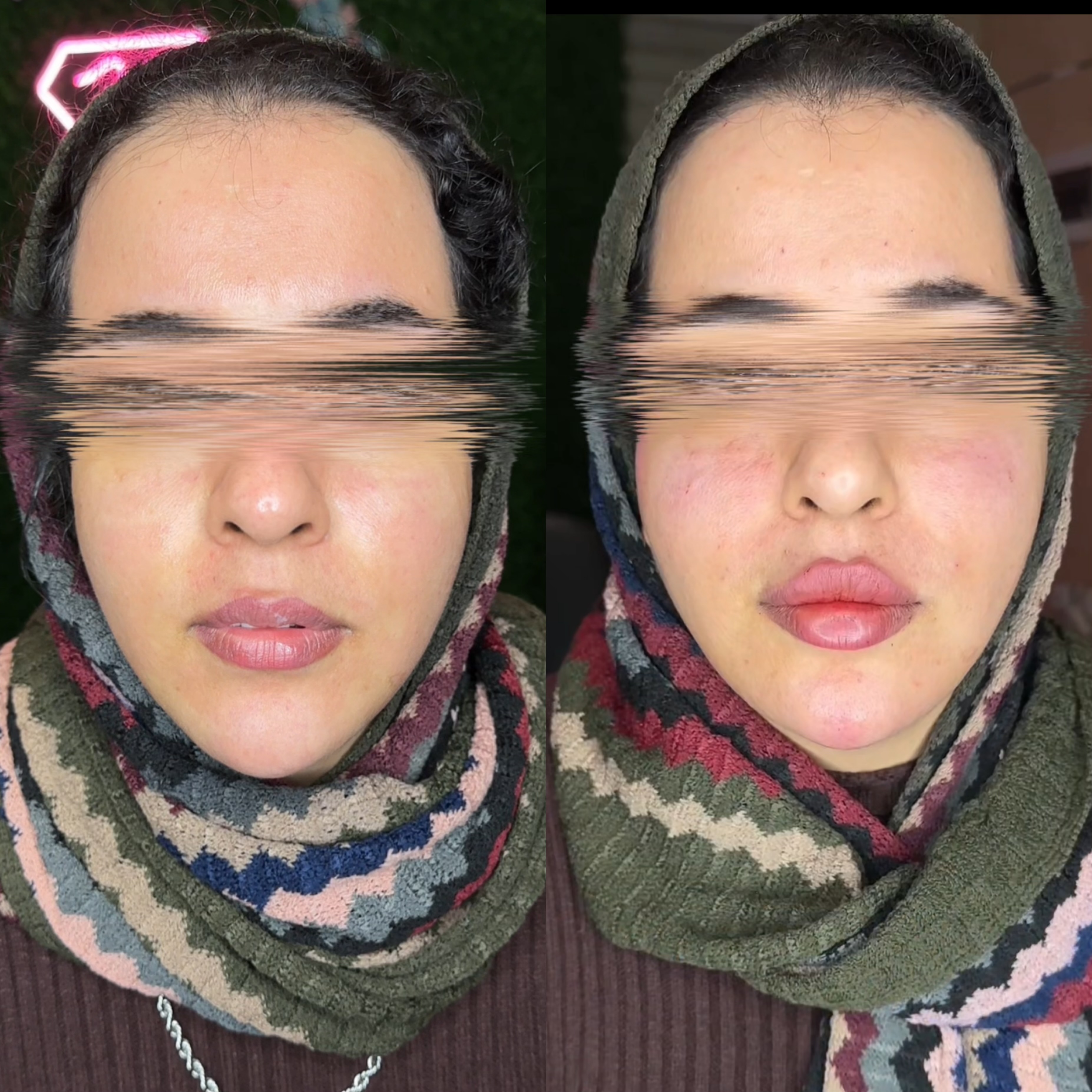 خدمات ژل و بوتاکس