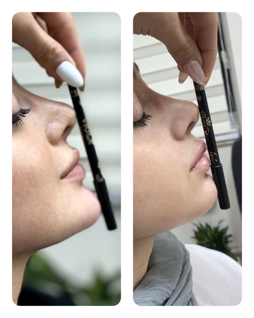 دكتور في خدمات التجميل في مشهد