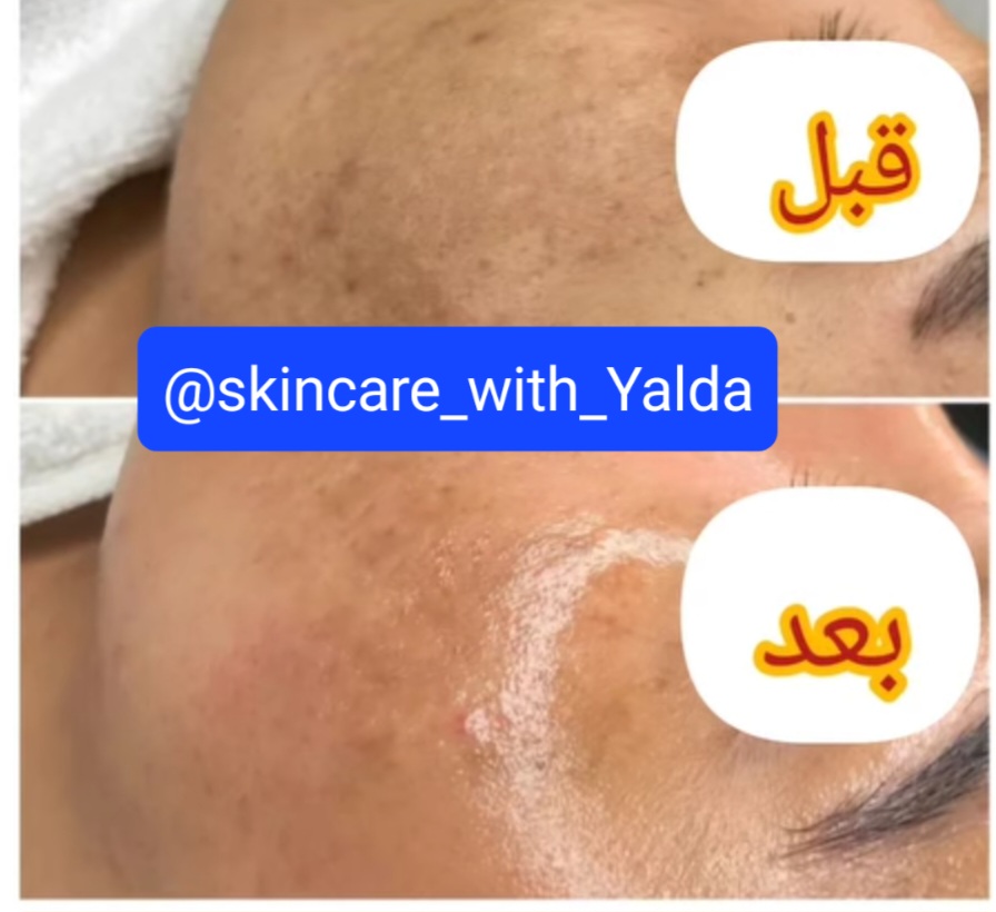 خدمات فیشال در آکادمی پوست