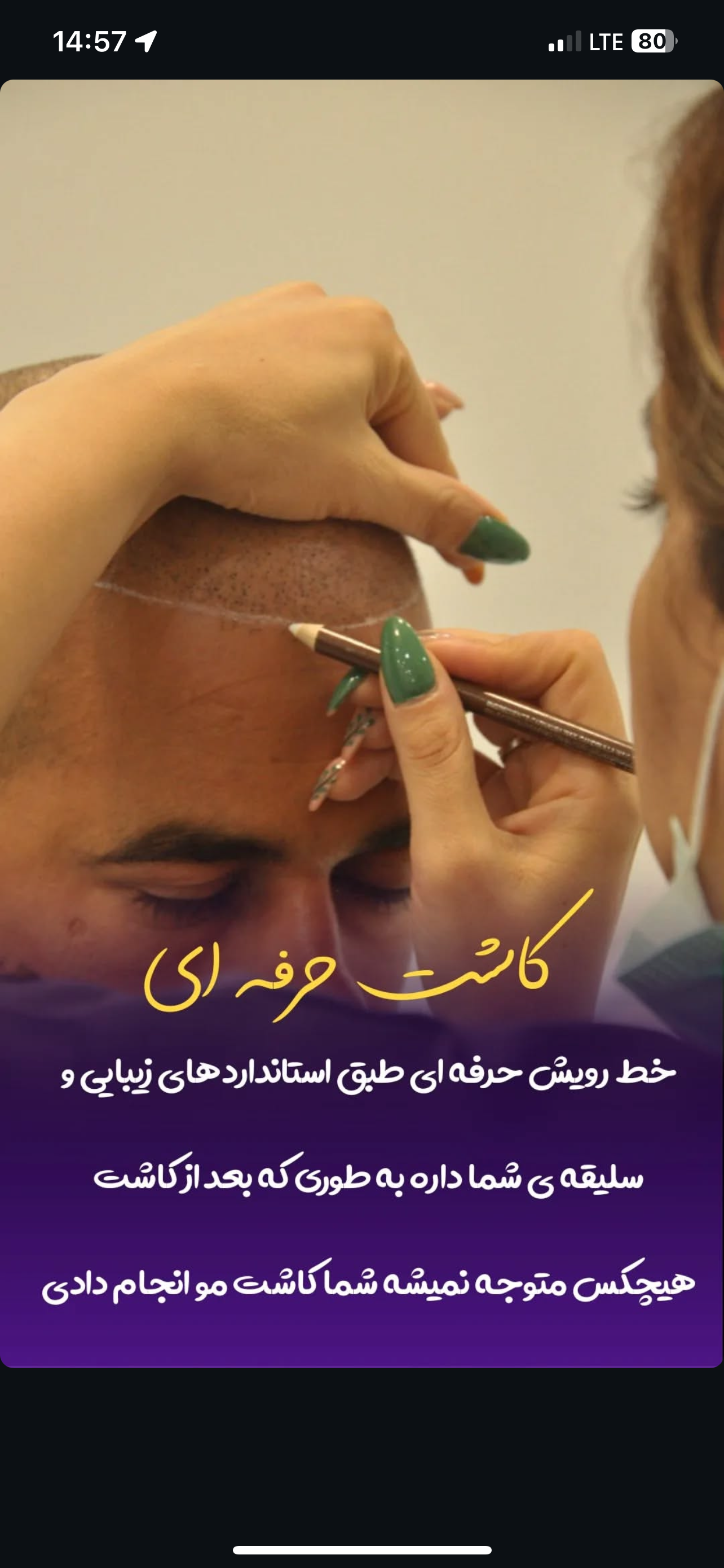 كاشت مو تخصصي خدامي