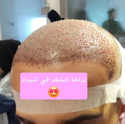 Beauty surgery and treatment