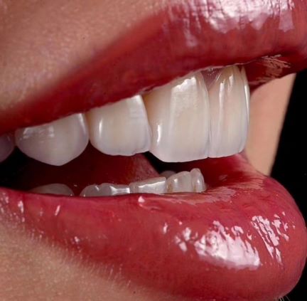 Beauty surgery and treatment