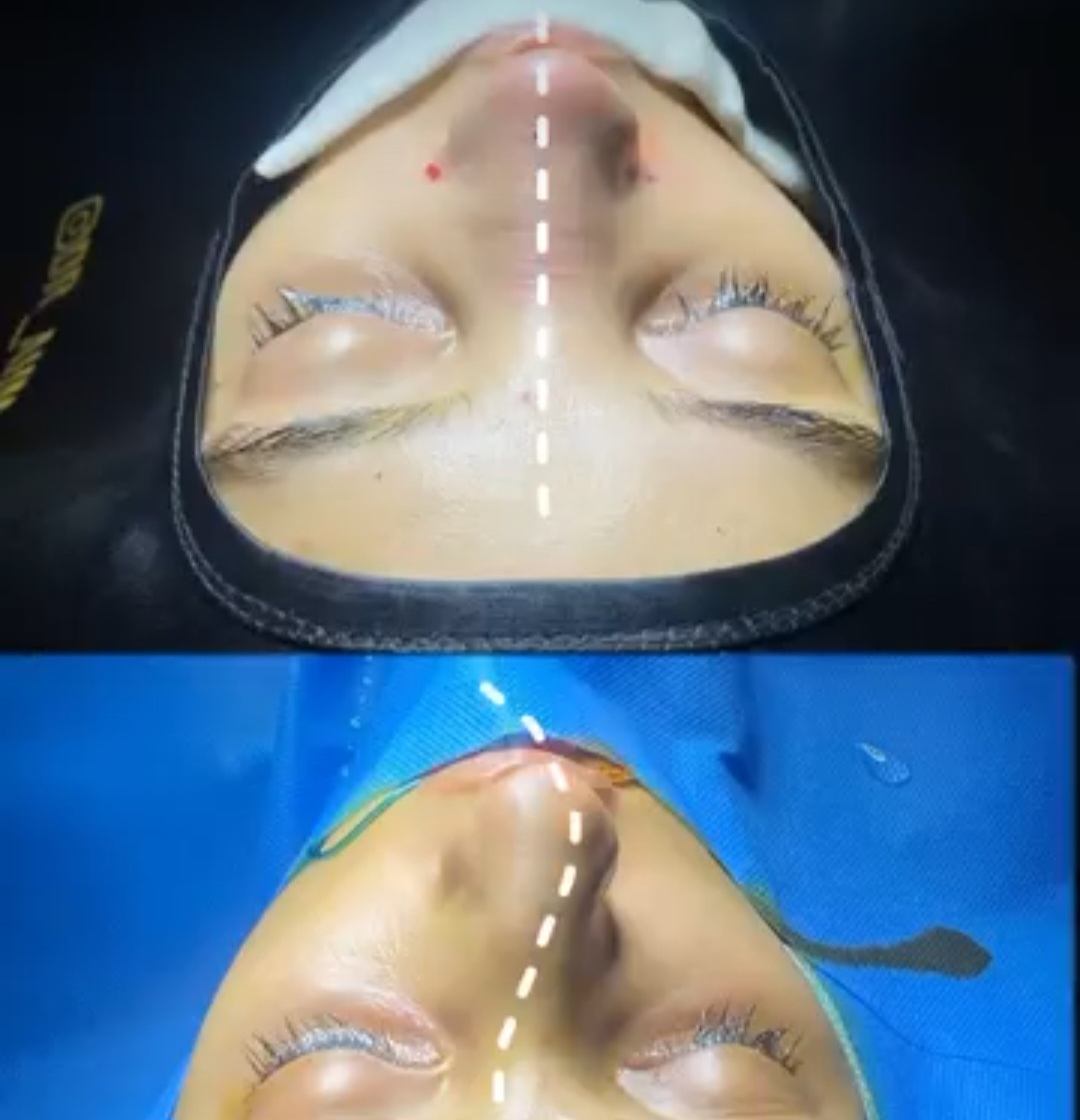 جراحی زیبایی