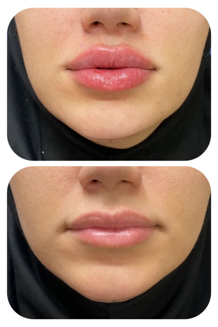 دكتور في خدمات التجميل في مشهد