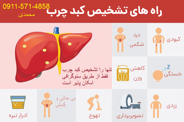درمان آسان و قطعی کبد چرب