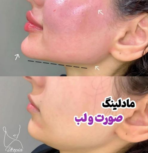 کلینیک زیبایی یوتوپیا