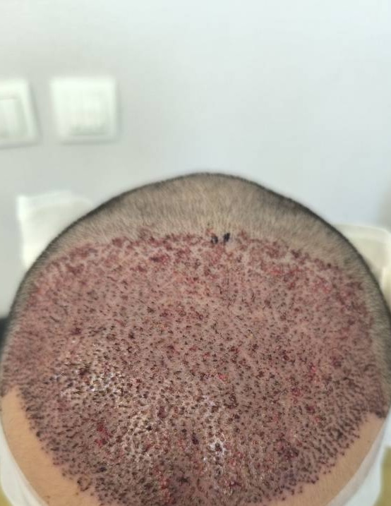 جشنواره تابستانه کاشتمو