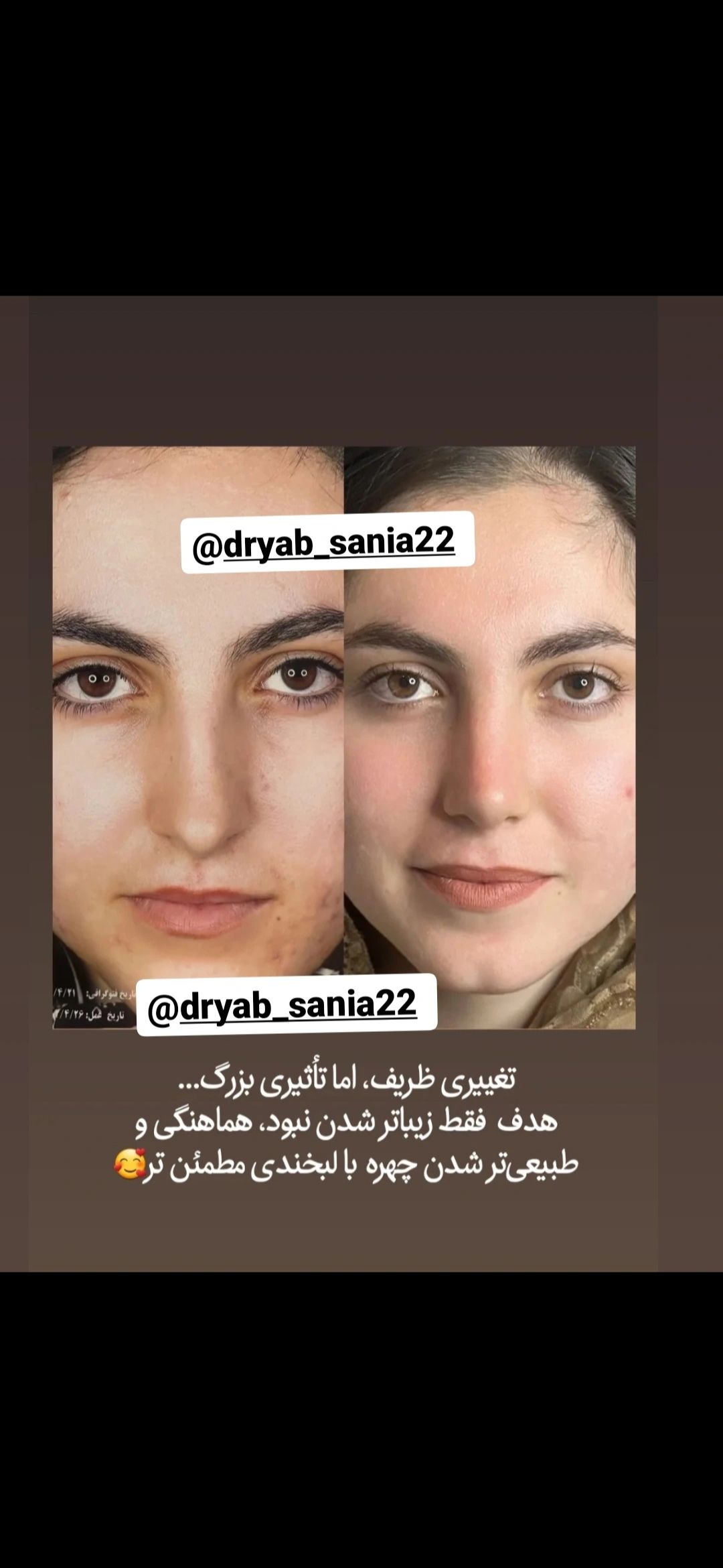 جراحی های زیبایی