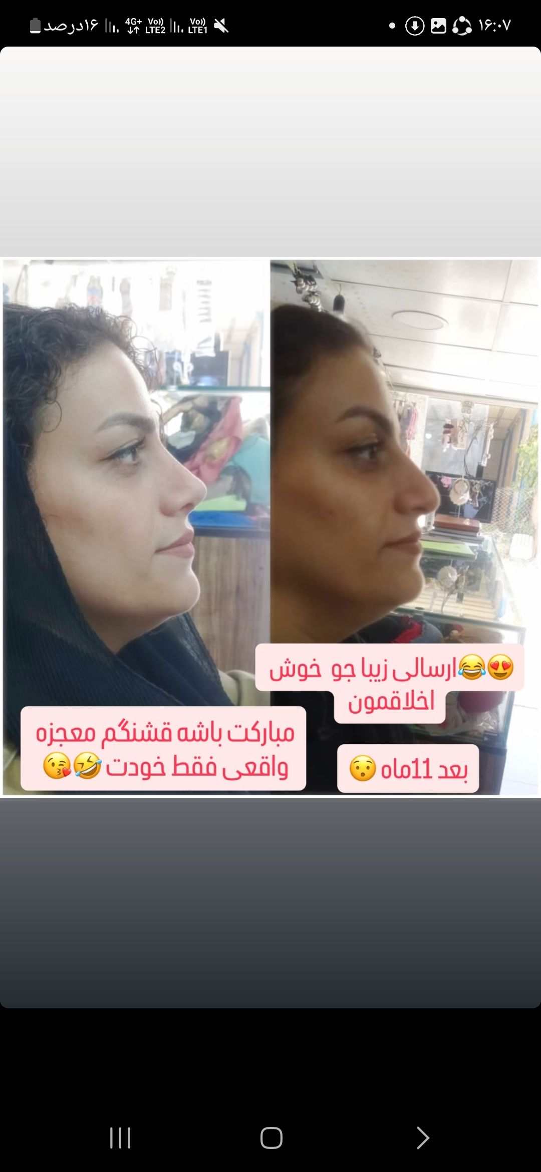جراحی های زیبایی