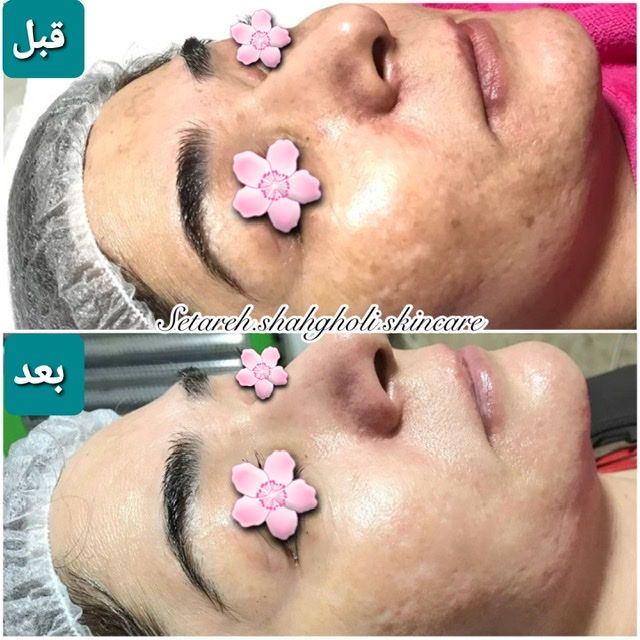 خدمات زيبايي