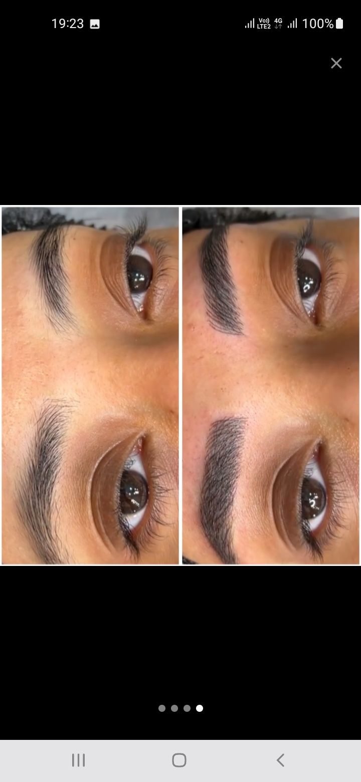میکروبلیدینگ تخصصی ابرو  