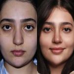 جراحی بینی و پلک