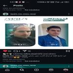 کاشت مو و کاشت ابرو