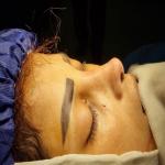  . جراحی بینی و ایمپلنت های دندانی 