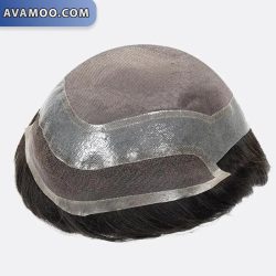 پروتز مو آنکارایی