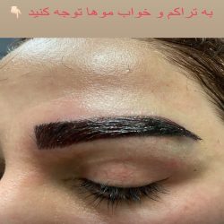 كاشت تخصصي ابرو و مو