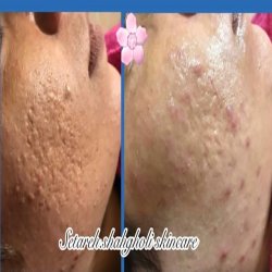 خدمات زيبايي خدمات زيبايي