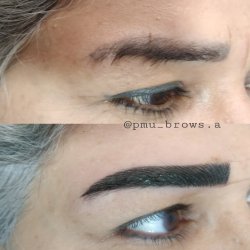 میکروبلیدینگ تخصصی ابرو  