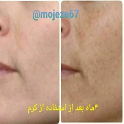 کرم ضد لک بیوتی پلاس
