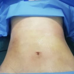 انواع جراحی زیبایی صورت و بدن