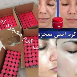 کرم لکه بر و سفید کننده