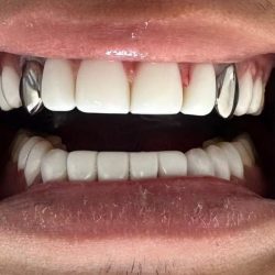 Dental laboratory  