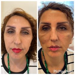 پزشک پوست مو زیبایی و لیزر پزشک پوست مو زیبایی و لیزر